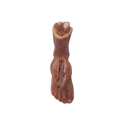 Oyoq patologiyasi